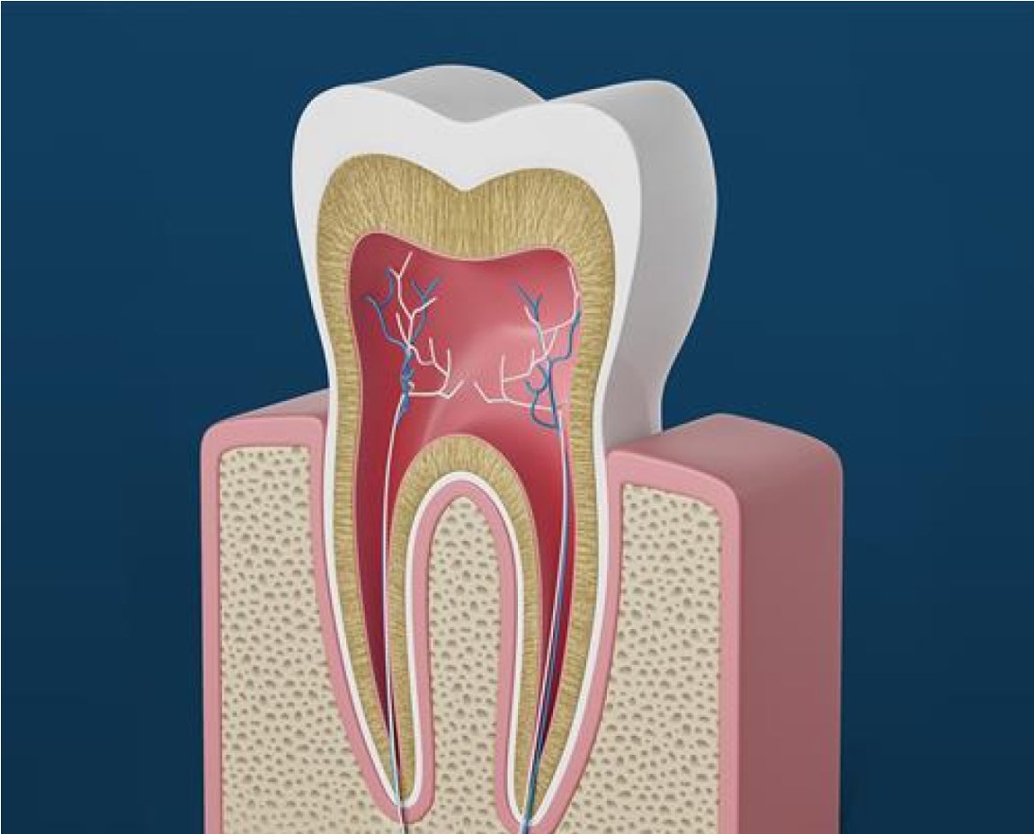 Top Signs You Might Need a Root Canal Treatment