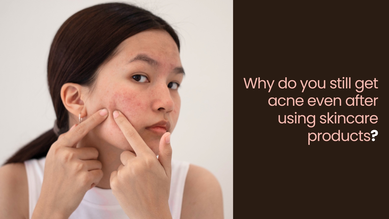 Why do you still get acne even after using skincare products?