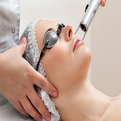 Will PICO laser help with large pores?