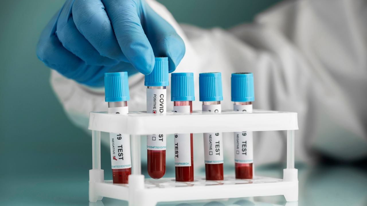Comprehensive Guide to Blood Test in Bangalore - Your Health Matters