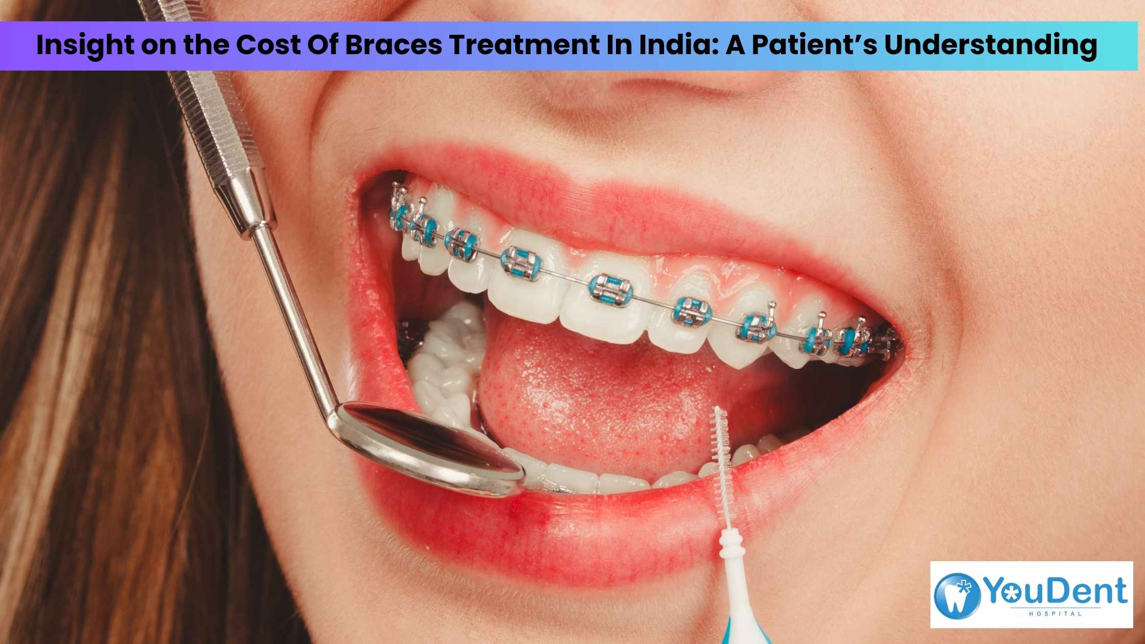 Say Cheese with Confidence: Claiming the Benefits of Smile Design