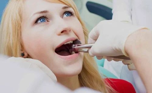 Tooth Extraction: Guide to Price & Quality