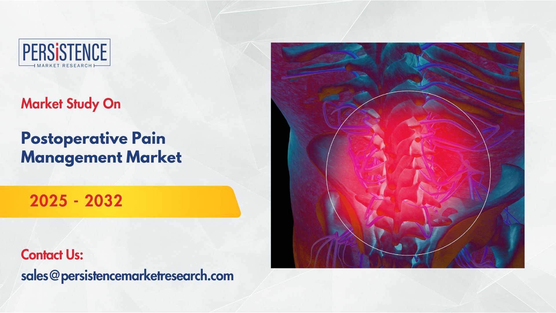 Postoperative Pain Management Market Strategies of Leading Pharmaceutical Firms