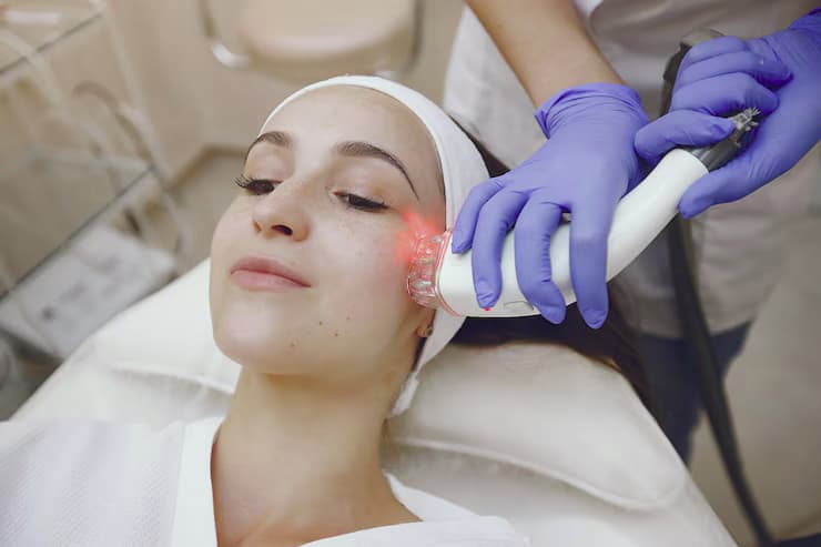 Say Goodbye to Pigmentation with Laser Treatments in Nottingham