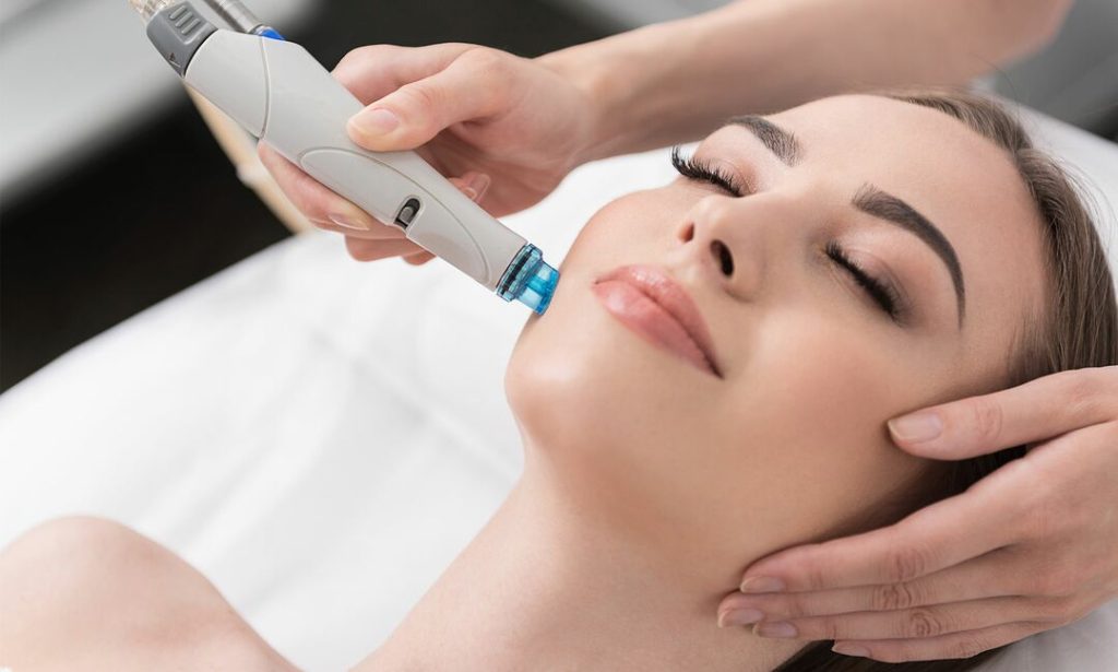 From Acne Scars to Aging: What Chemical Peels Can Really Fix