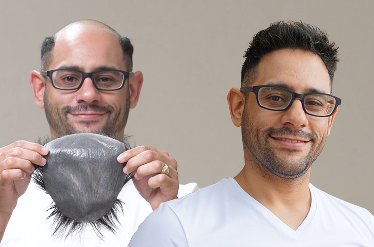 Toupee Care 101: How to Maintain Your Hairpiece for Longevity