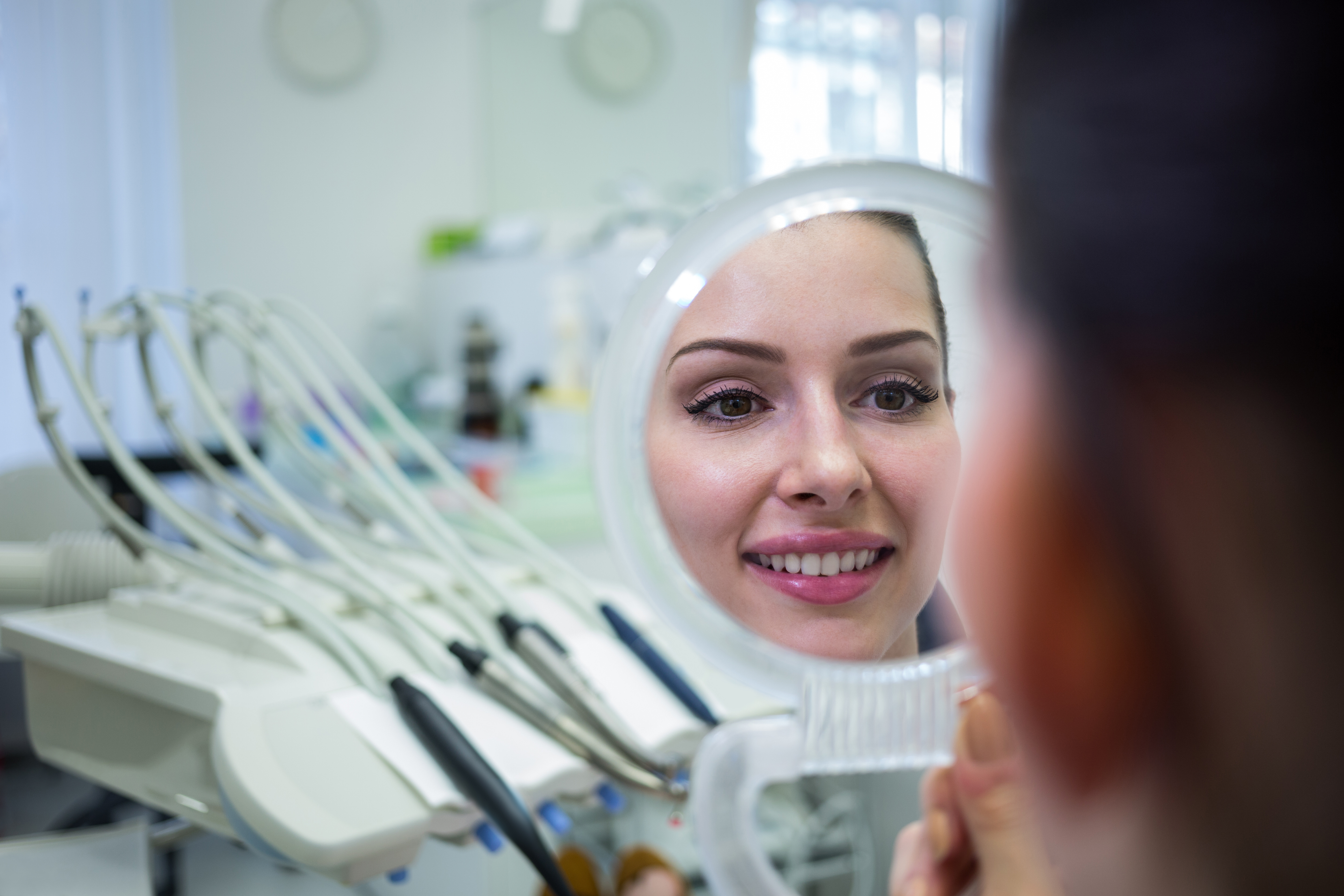 Key Benefits of Getting a Smile Makeover in Fort Lauderdale