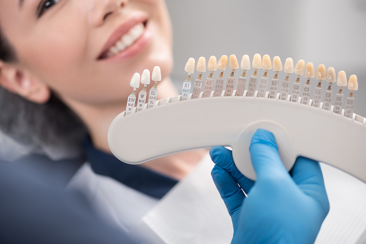 From Consultation to Final Smile: Dental Veneers Journey in Islamabad