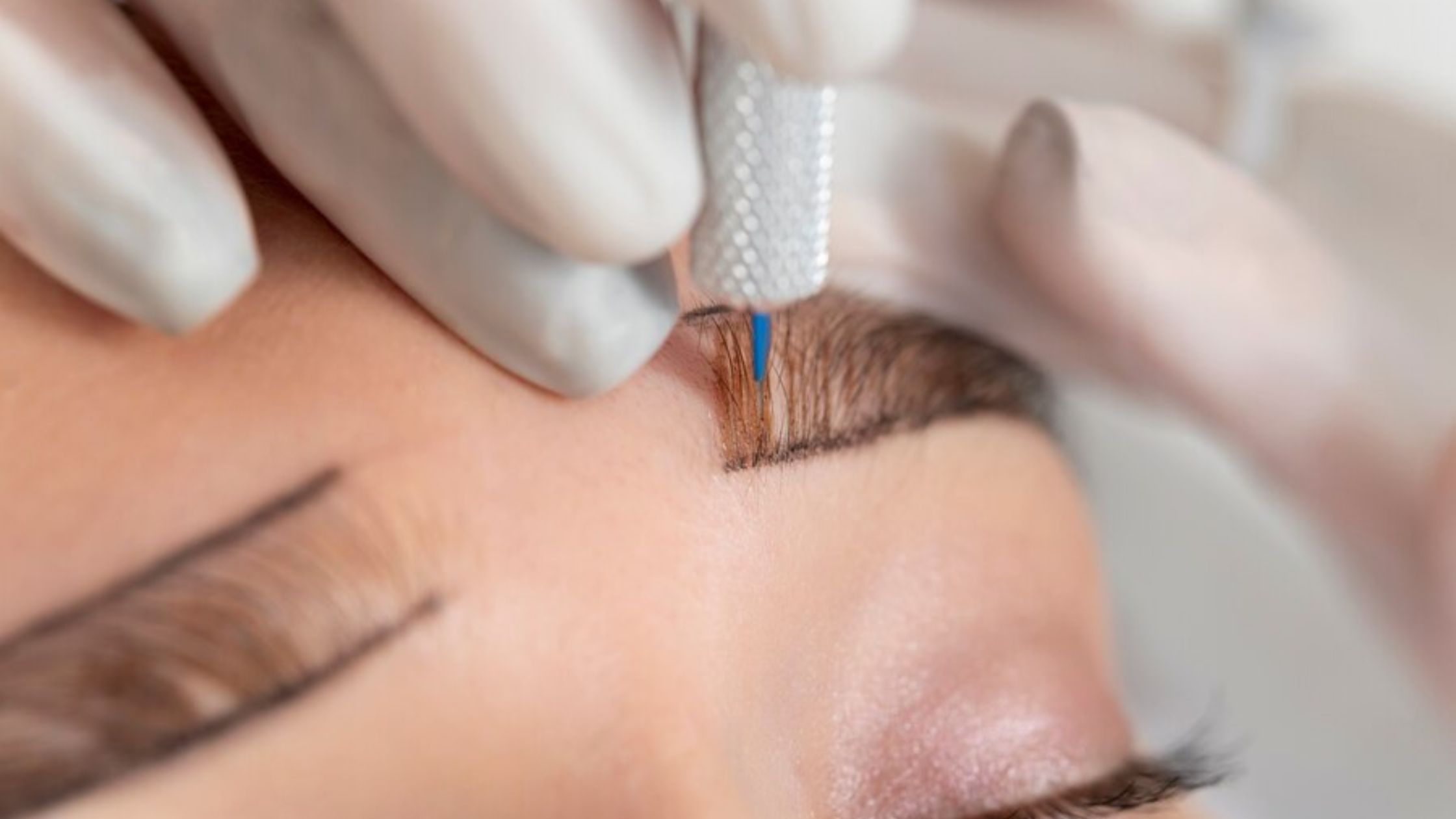 How Much Does an Eyebrow Transplant Cost? A Complete Guide