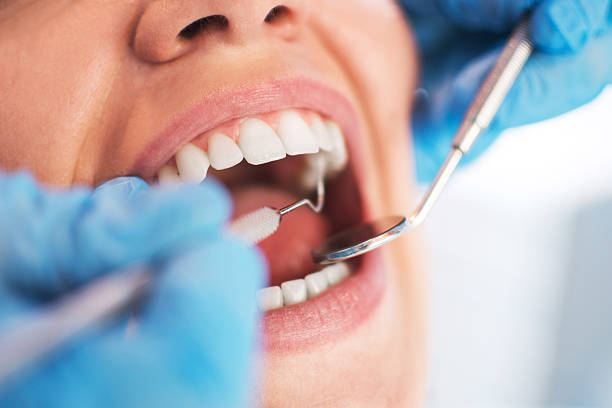 Dentist in Riyadh: Affordable Teeth Cleaning Experts