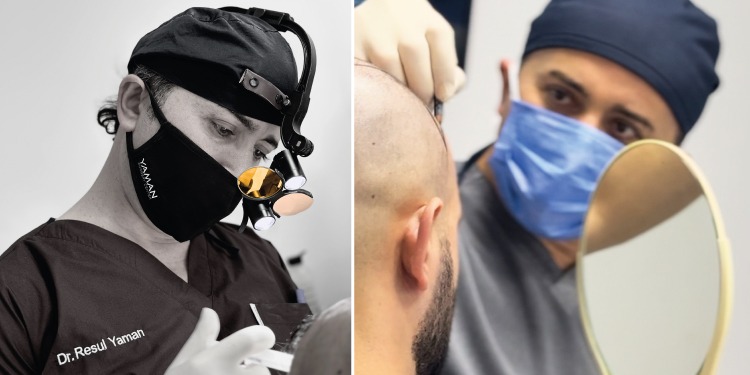Hair Transplant Turkey: Best Clinics, Real Before After Cases & What to Know