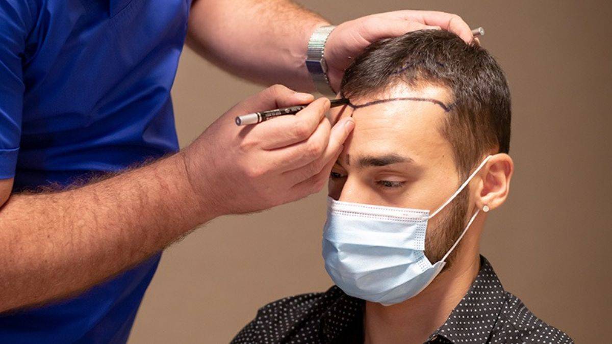 How Much Does a Hair Transplant Cost in Islamabad?