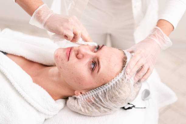 HANDOK’s Strategic Role and Innovations in South Korea Professional Acne Medication Market