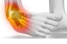 Why Won’t My Sprain/Strain Heal? (5 Hidden Reasons)