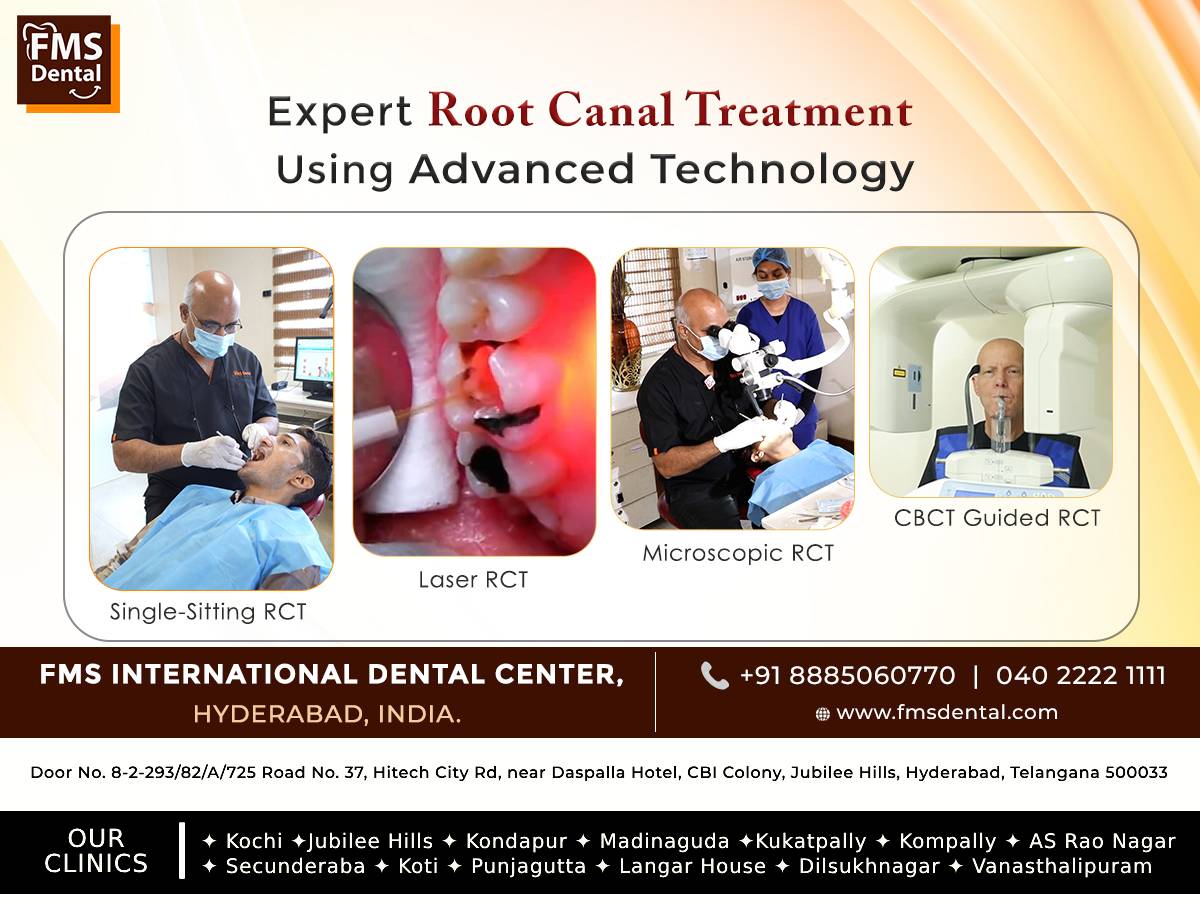 Comprehensive Root Canal Treatment at FMS Dental Clinic, Hyderabad