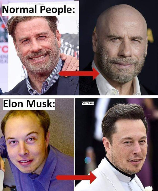 Celebrities Who Might Be Wearing Hair Systems (and Why It’s OK!)