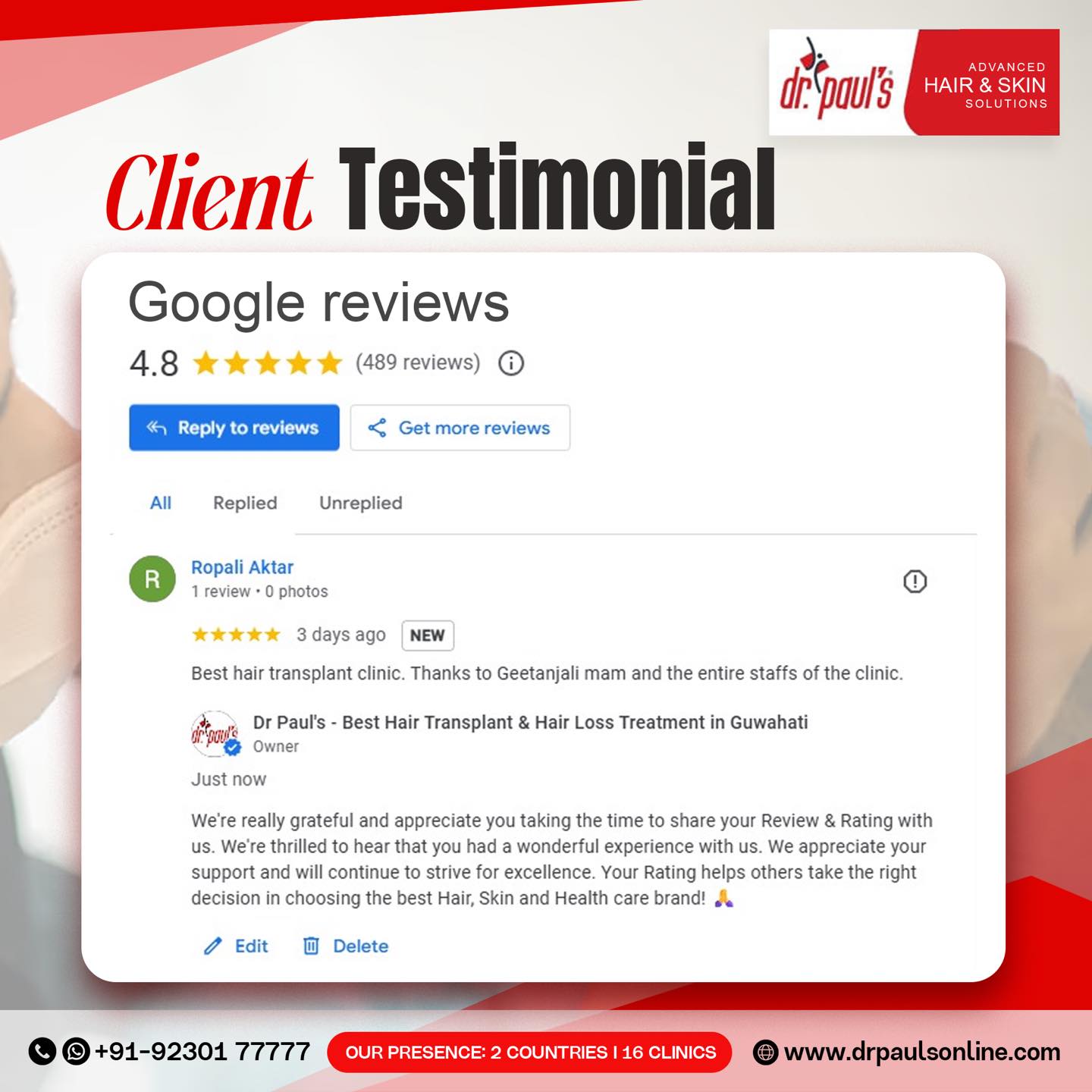 Regain Confidence with the Best Hair Loss Treatment and Hair Transplant in Kolkata