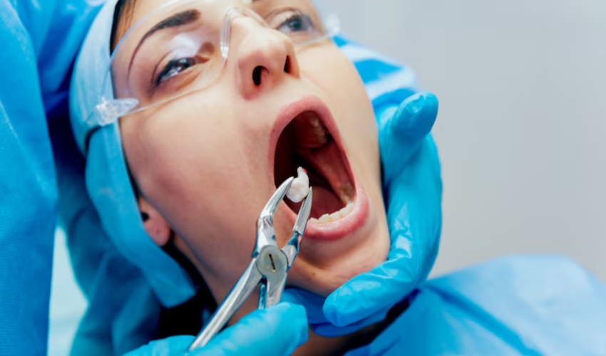 What are the main health issues caused by impacted wisdom teeth?