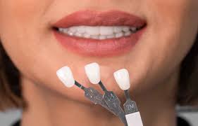 Is Invisalign Worth It? Brisbane Prices & Patient Insights