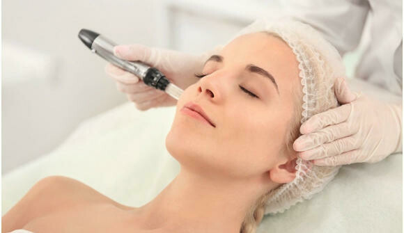 Microneedling for Teens: Is It Safe in Islamabad?