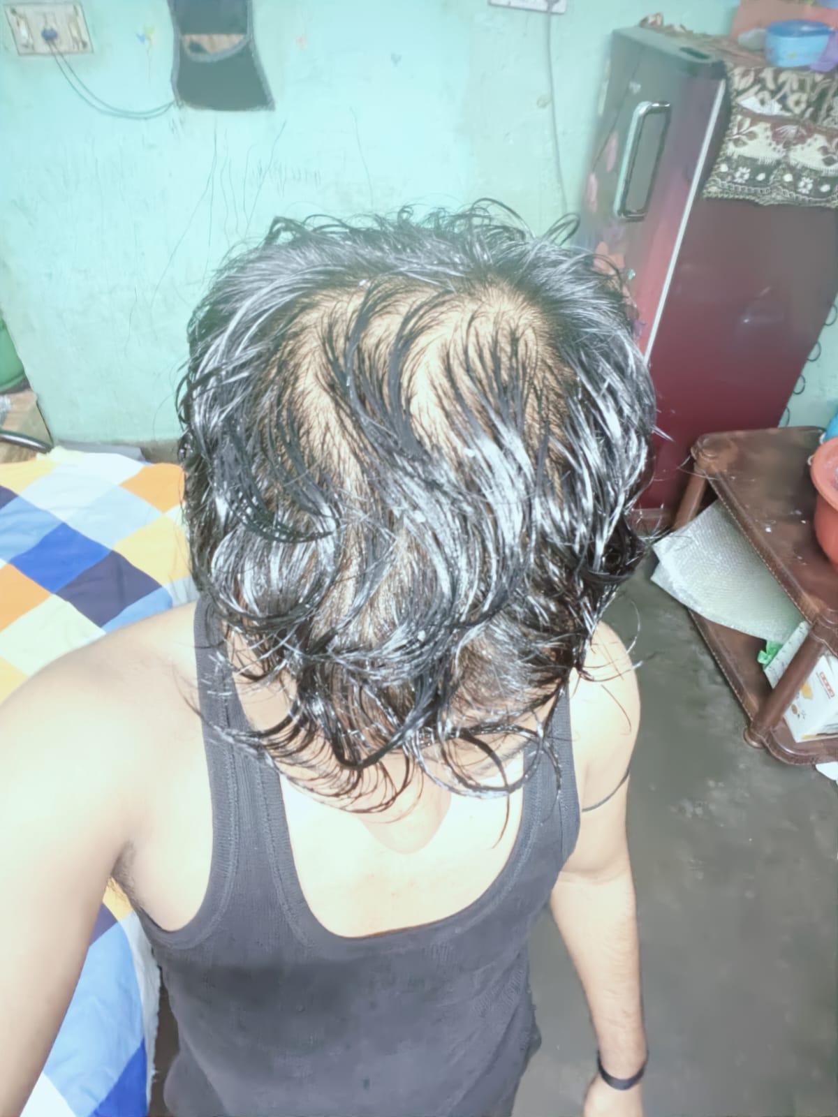 From Hair Fall Anxiety to New Hope: What I Learned About PP405