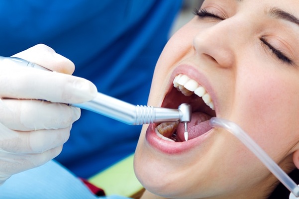 The Secret to a Fresh, Healthy Smile: Teeth Polishing Explained
