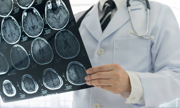 Expert Brain Function Tests in Miranda | Southern Neurology