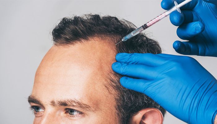 Get the Best Value PRP Therapy in Dubai