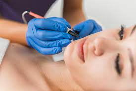 Does Electrolysis Hair Removal Leave Scars?