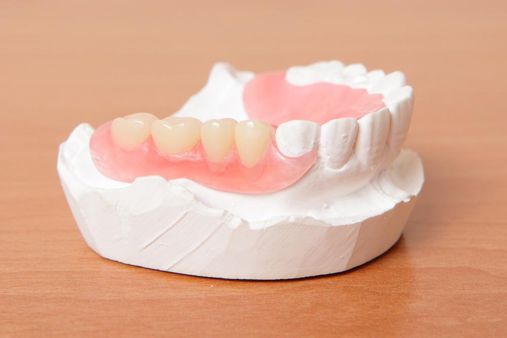 What Type of Dentures Are Right for You? A Comparison Guide