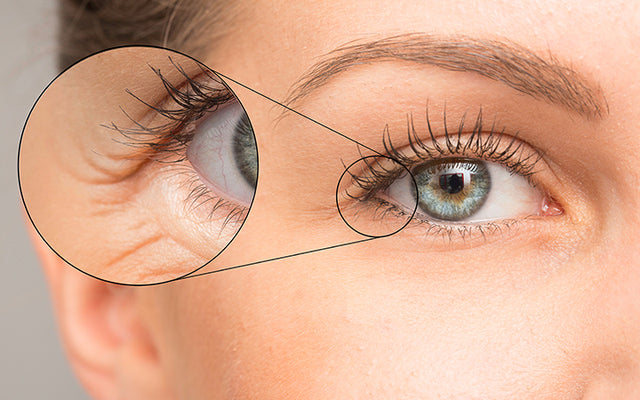 Does Fine Lines and Wrinkles Treatment Have Any Limits?