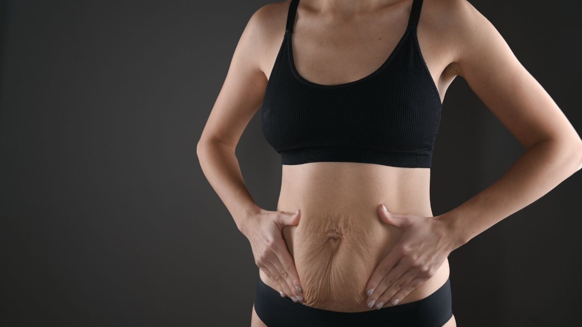 How Long Does Bariatric Surgery Take?