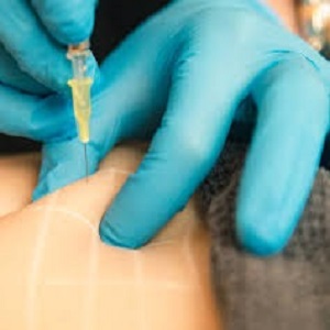 حقن إذابة الدهون في الرياض: الأطباء والتكاليف – دليلك لاختيار الأفضل
