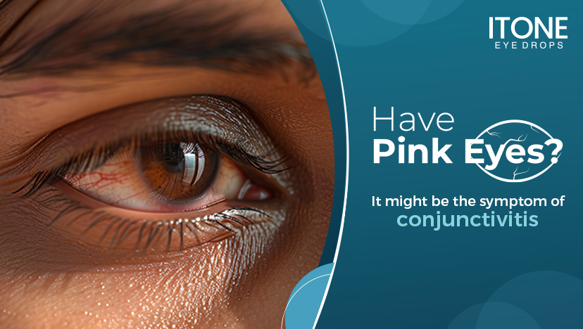 Itone Eye Drops for Conjunctivitis: Quick Relief Guide