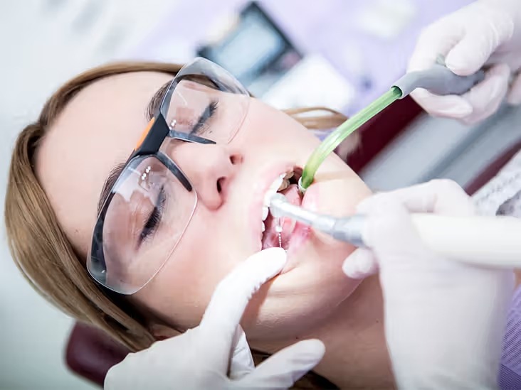Step-by-Step Guide to the Root Canal Treatment Procedure in Mississauga