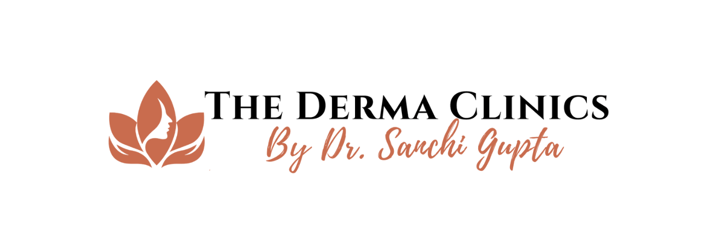 Atopic Dermatitis Treatments – Expert Solutions by Thederma Clinics