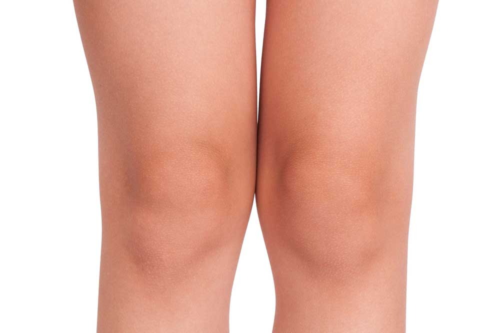 Is Skin Whitening Treatment Effective for Dark Knees?