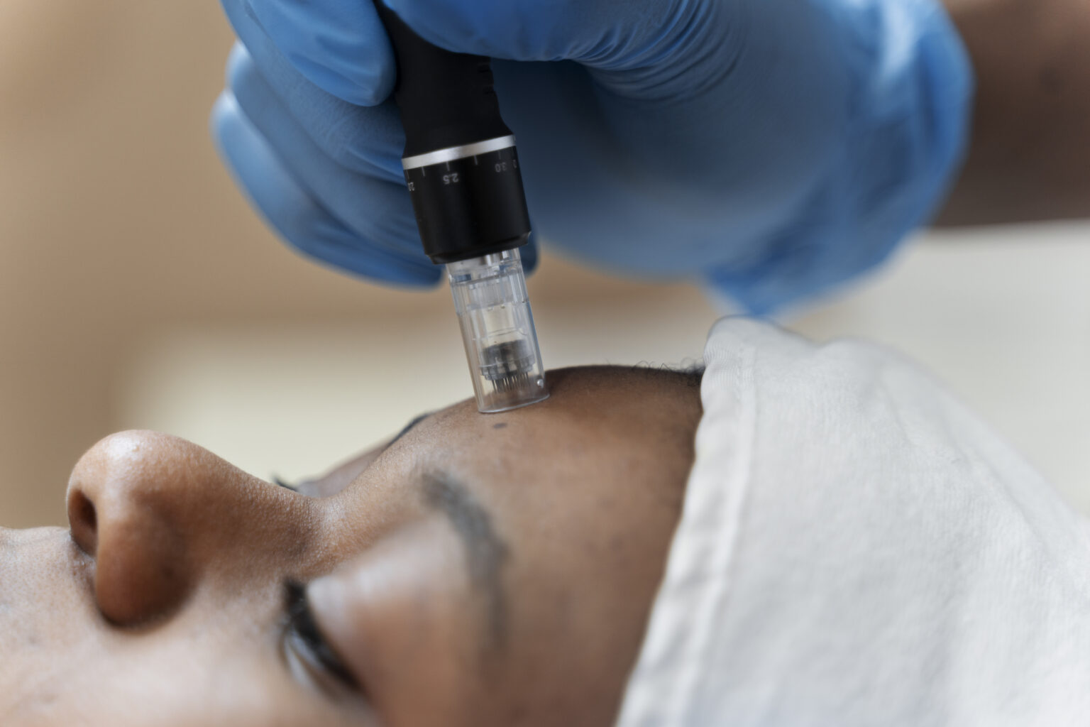 Discover the Best Botox and Micro Needling Services Near You at Harmony Aesthetics