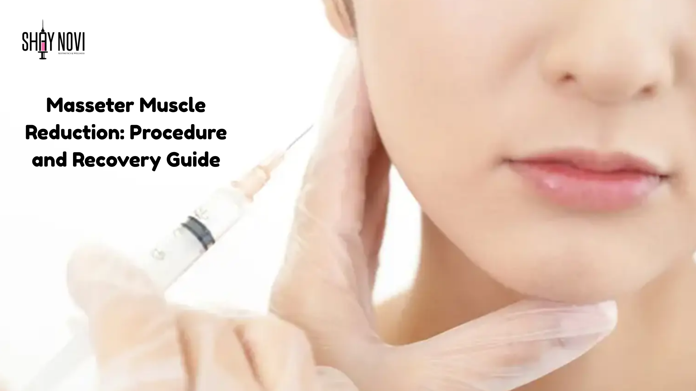 Masseter Muscle Reduction: Procedure and Recovery Guide