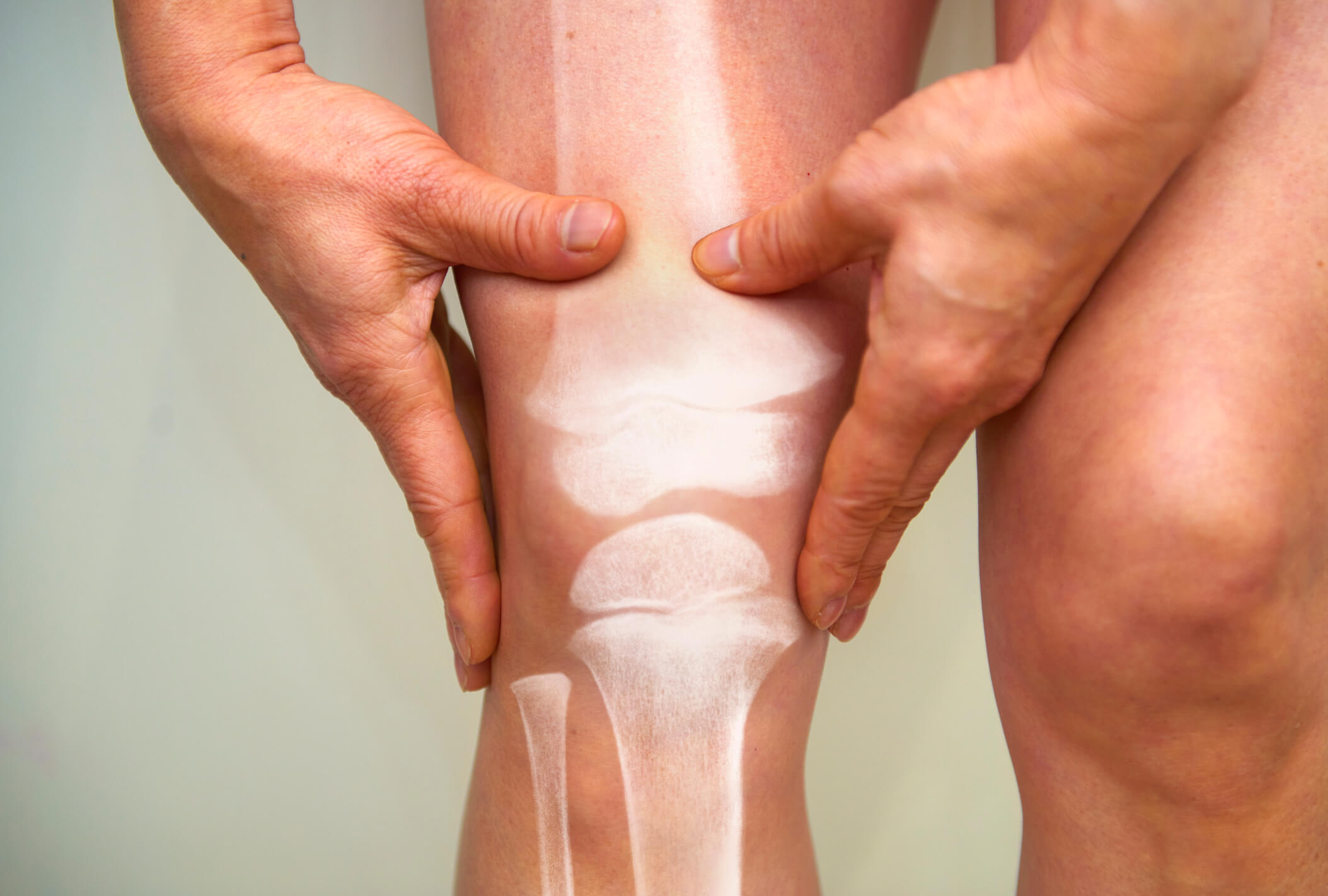 How does HRT affect bone density?