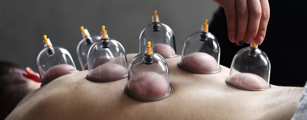Is Hijama effective for muscle tension?