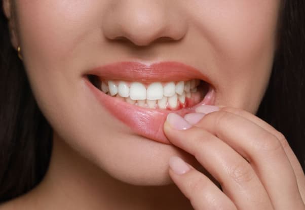 Early Signs of Gum Disease You Shouldn’t Ignore