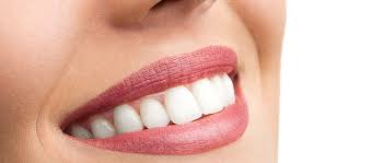 Top 5 Benefits of Gum Contouring You Didn’t Know About