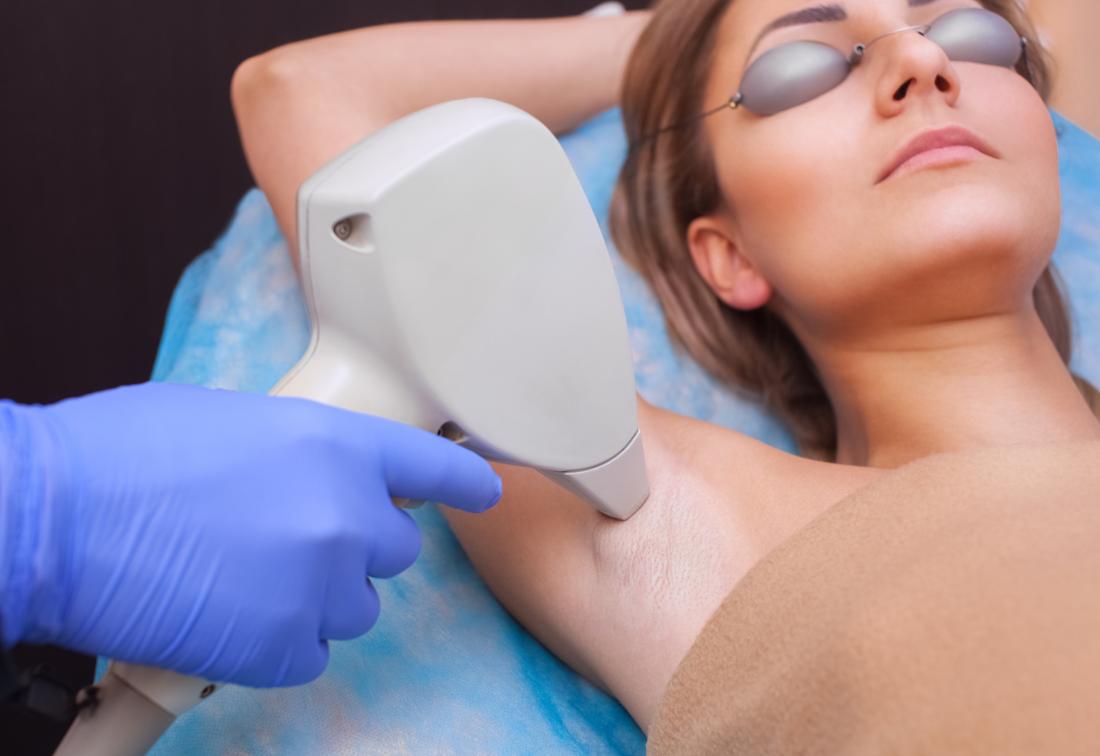 What are the types of Laser Hair Removal?