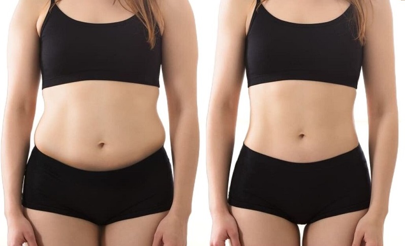 From Bulky to Beautiful – Liposuction Redefined