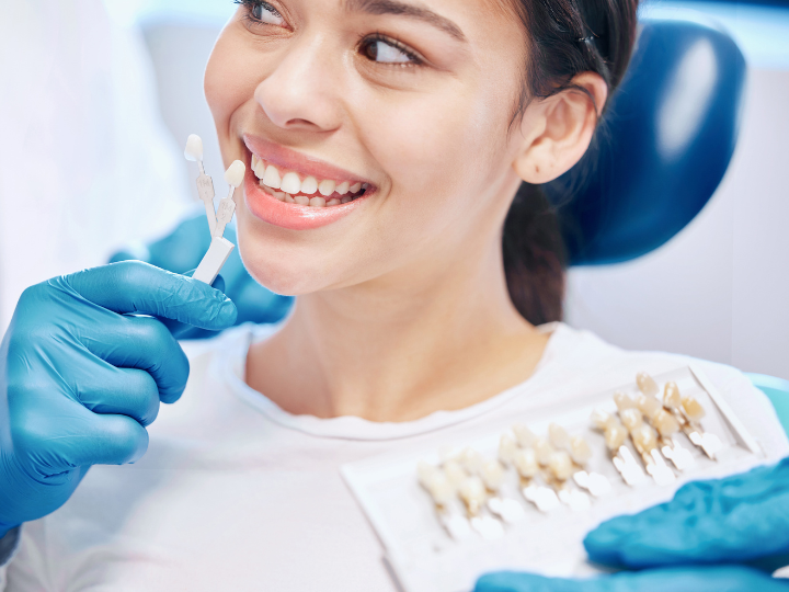 When Should You Consider Getting Dental Veneer in Fairfax, VA?