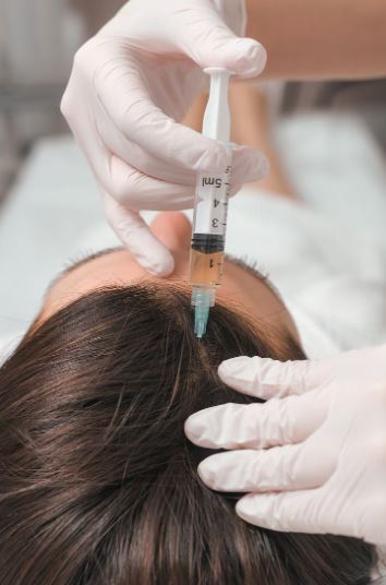 Microneedles, Lasers & PRP: Synergistic Strategies That Supercharge Hair Density