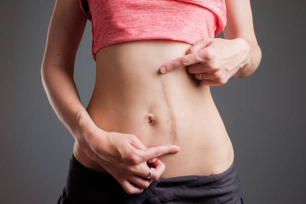 How Painful Is Laser Scar Removal Compared to Surgery?