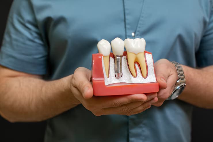 Medford Dental Implant Specialists Deliver Strong, Natural-Looking Results