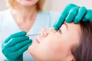 Scarless Rhinoplasty in Islamabad: Is It Possible?